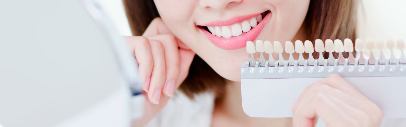 Smile360 Teeth Whitening Canada