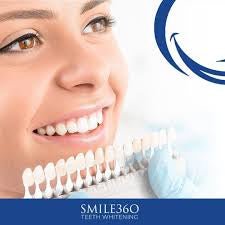 THE DELUXE Retailer Starter Bundle (30 pieces, 5 SKU’s) | Smile360 Teeth Whitening